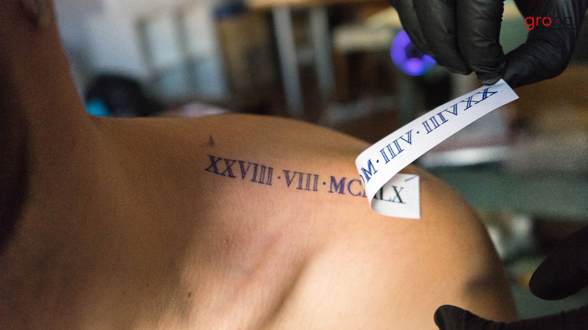 Is Tattoo Removal Really Permanent?